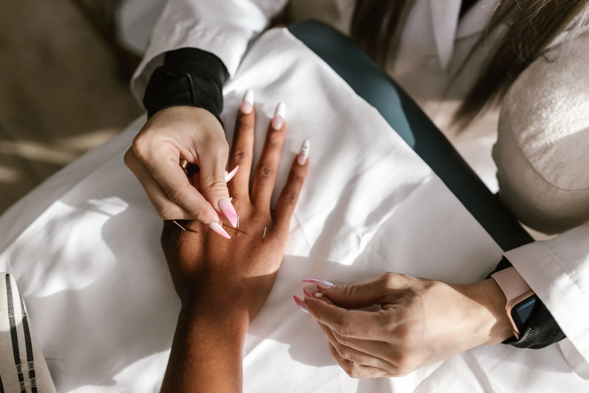 Practitioner's hands placing fine needles in a client's hand